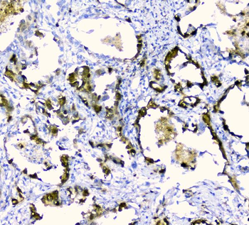 Anti-CDA Antibody