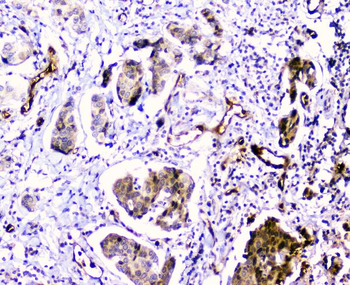 Anti-CDA Antibody