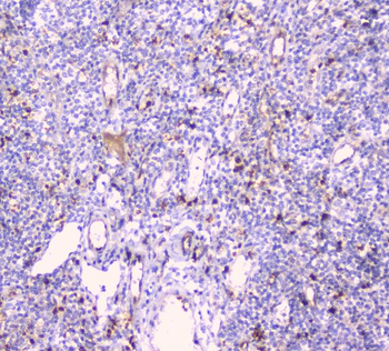 Anti-CDA Antibody