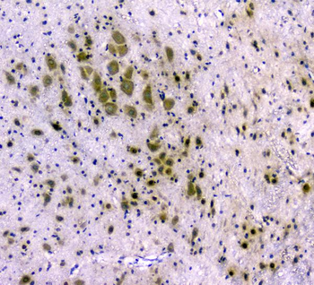 Anti-CDA Antibody