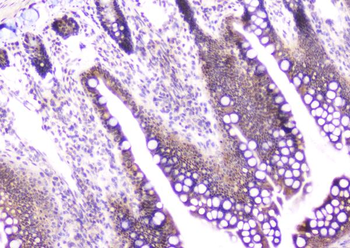 Anti-CDA Antibody