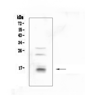 Anti-CDA Antibody