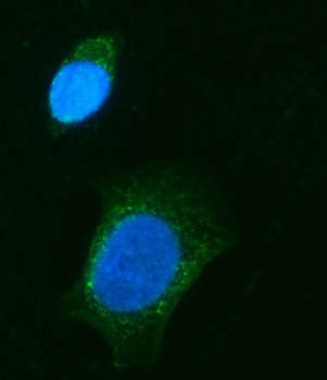 Anti-CHM Antibody