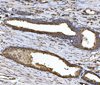 Anti-CHM Antibody