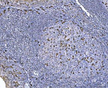 Anti-CHM Antibody