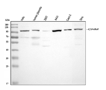 Anti-CHM Antibody
