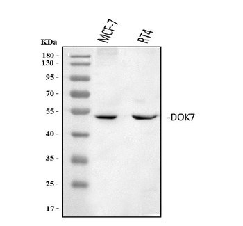 Anti-DOK7 Antibody