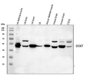 Anti-DOK7 Antibody