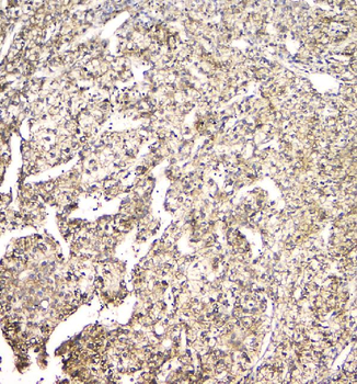 Anti-TMEM166/EVA1A Antibody