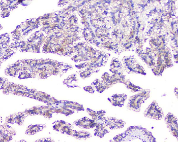 Anti-TMEM166/EVA1A Antibody