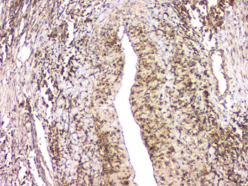 Anti-HECTD3 Antibody