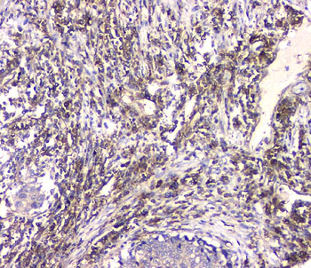 Anti-HECTD3 Antibody