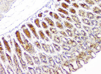 Anti-HECTD3 Antibody