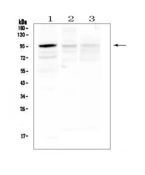 Anti-HECTD3 Antibody