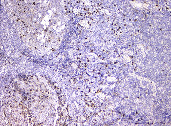 Anti-IGLL1 Antibody