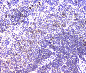 Anti-IGLL1 Antibody