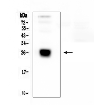 Anti-IGLL1 Antibody