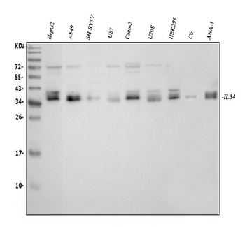 Anti-IL34 Antibody