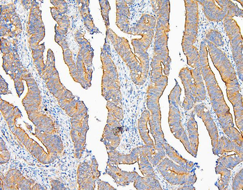 Anti-IQGAP1 Antibody