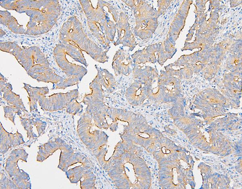 Anti-IQGAP1 Antibody