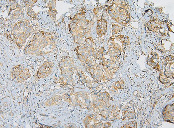 Anti-IQGAP1 Antibody