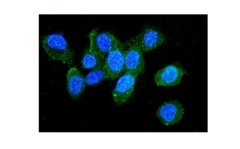 Plastin L/LCP1 Antibody