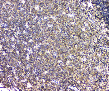 Plastin L/LCP1 Antibody