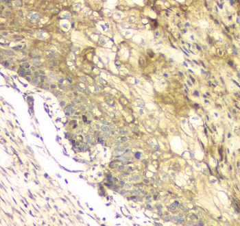 Anti-MCUR1 Antibody