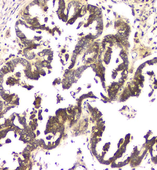 Anti-MCUR1 Antibody