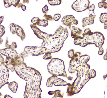 Anti-MCUR1 Antibody