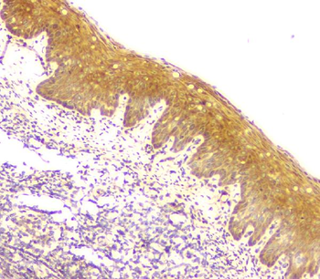 Anti-MCUR1 Antibody
