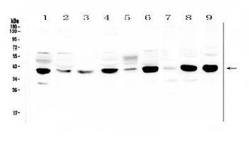 Anti-MCUR1 Antibody