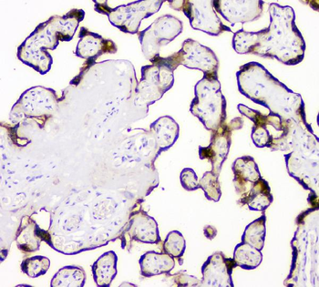 Anti-TPA Tissue Plasminogen Activator/PLAT Antibody