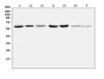 Anti-TPA Tissue Plasminogen Activator/PLAT Antibody
