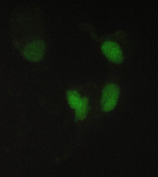 Anti-PPCS Antibody