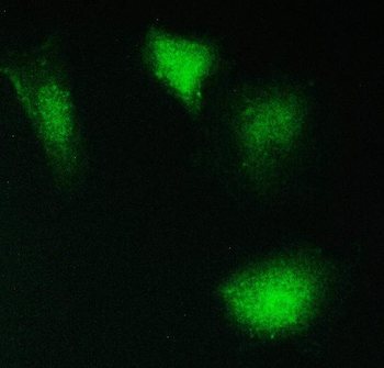 Anti-PPCS Antibody