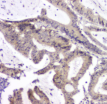 Anti-PPCS Antibody