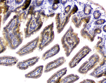 Anti-PPCS Antibody