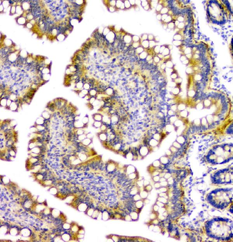 Anti-PPCS Antibody
