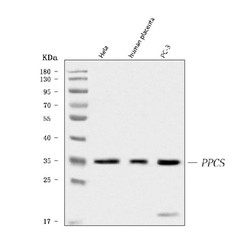 Anti-PPCS Antibody
