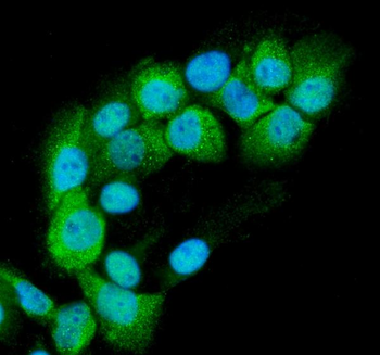 Anti-RAB11B Antibody