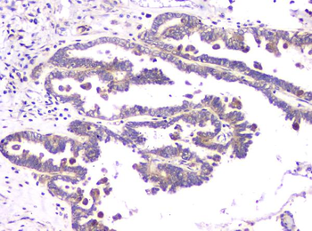 Anti-RAB11B Antibody