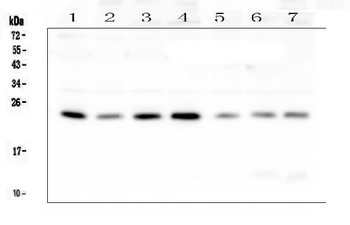 Anti-RAB11B Antibody