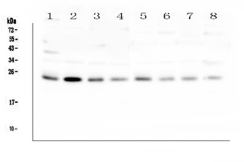 Anti-RAB11B Antibody