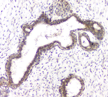 Anti-RHOB Antibody