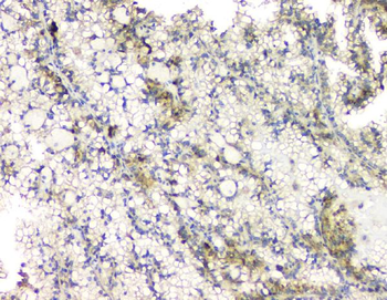 Anti-RHOB Antibody