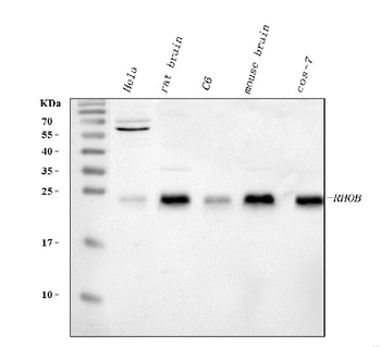 Anti-RHOB Antibody