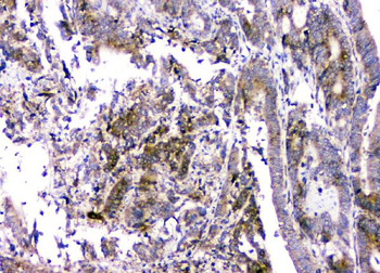 Anti-RMI2 Antibody