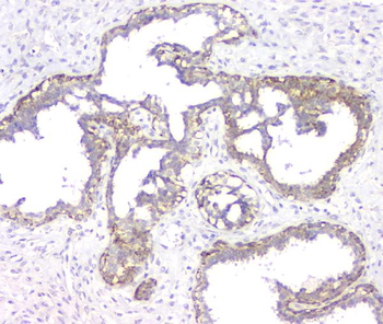 Anti-RMI2 Antibody