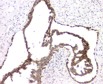 Anti-RMI2 Antibody